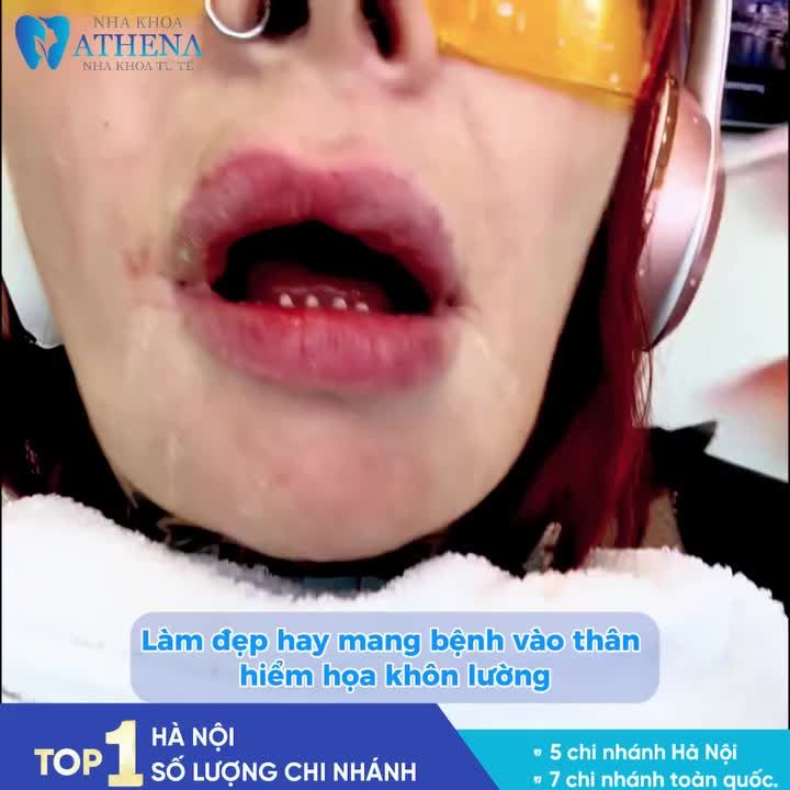 16 CHIẾC RĂNG SỨ GIÁ 3 TRIỆU – CHIÊU TRÒ MARKETING HAY "BẢN ÁN" CHO SỨC KHỎE?