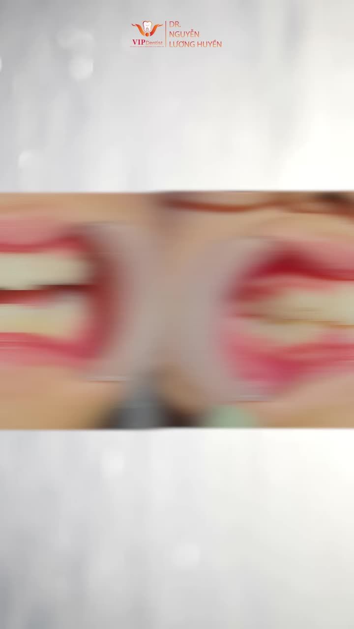 Từ khớp cắn sâu đến khớp cắn chuẩn, răng đều đẹp