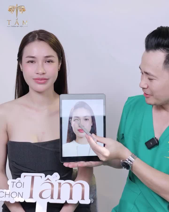 Chỉ một điều chỉnh nhỏ, mang lại đôi mắt hài hòa hơn