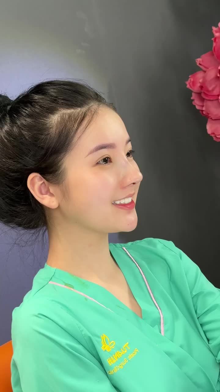 Sở hữu khuôn mặt ưa nhìn nhưng muốn xinh đẹp, thanh tú, nổi bật hơn thì chọn ngay nâng mũi cấu trúc.