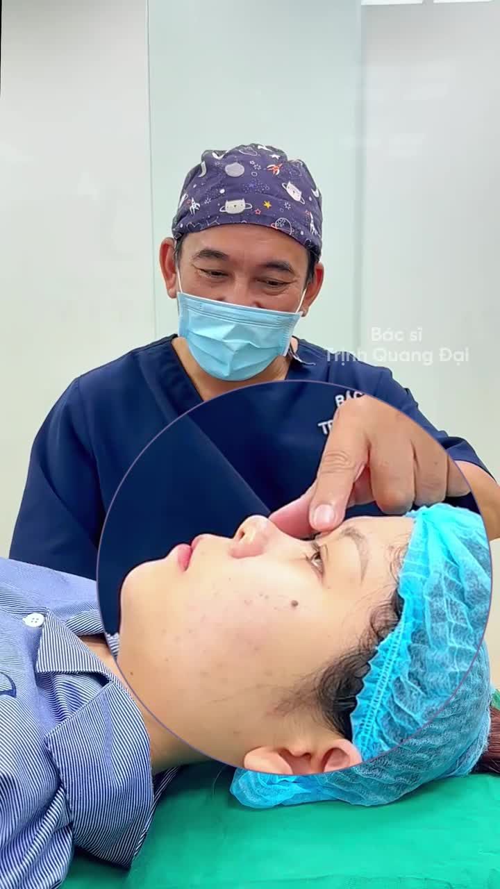 MŨI HẾCH CAO VÔ TÌNH LỘ KHUYẾT ĐIỂM