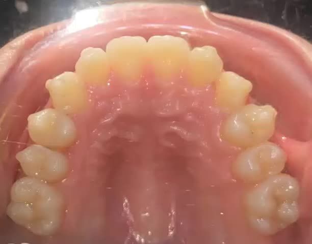 Brances chinh nha ThayĐổi Nụ Cười invisalign