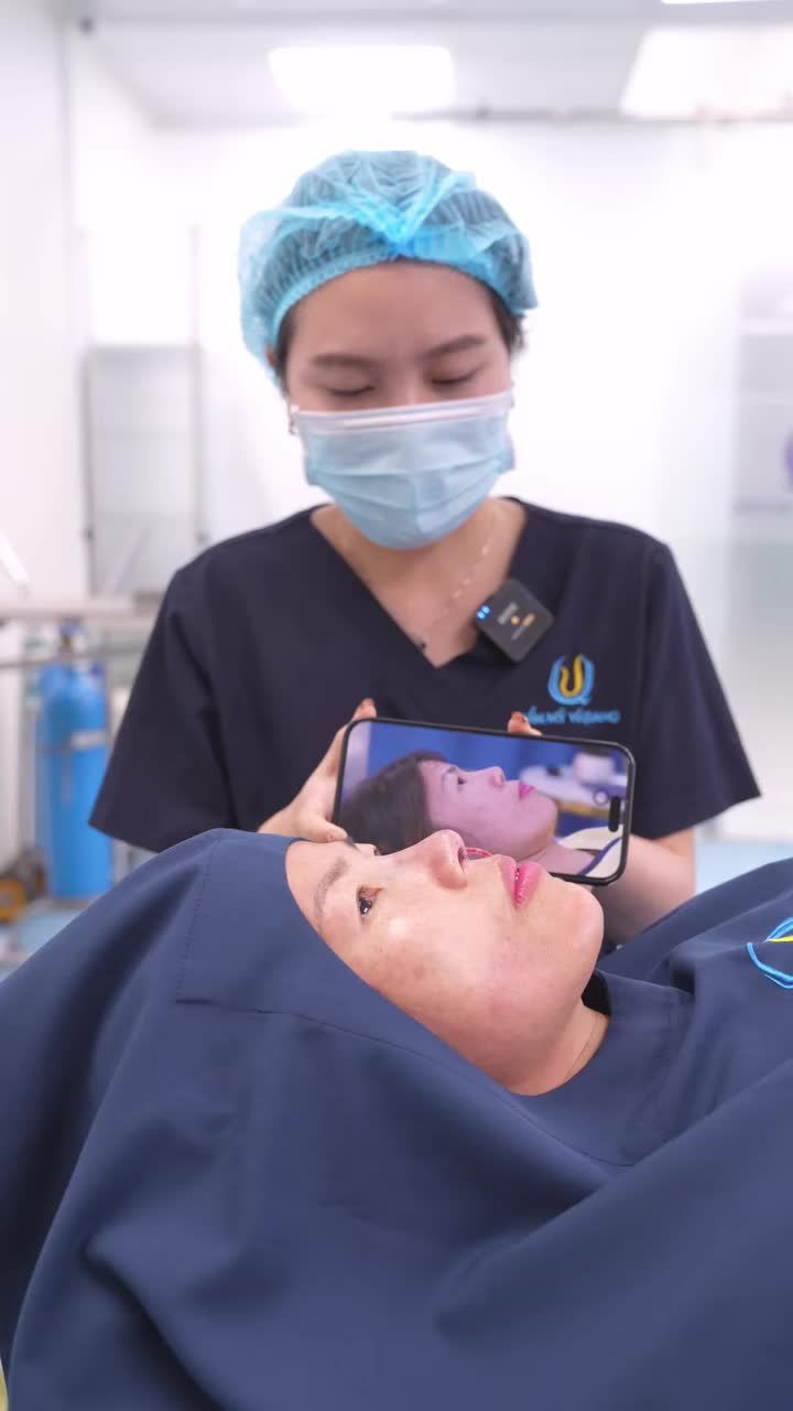 Kết quả của case sửa mũi, tháo bỏ chất liệu 20 năm cho chị gái