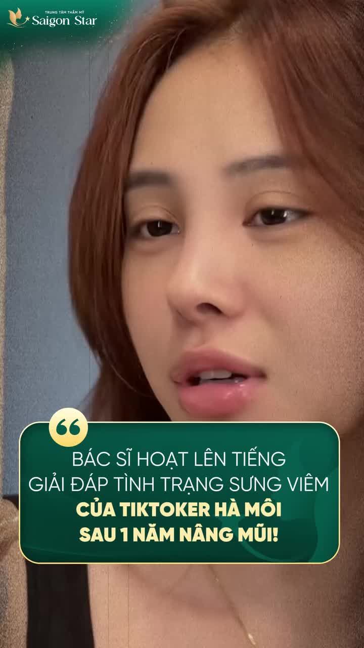 BÁC SĨ HOẠT GIẢI ĐÁP TÌNH TRẠNG SƯNG VIÊM SAU 1 NĂM NÂNG MŨI!!!