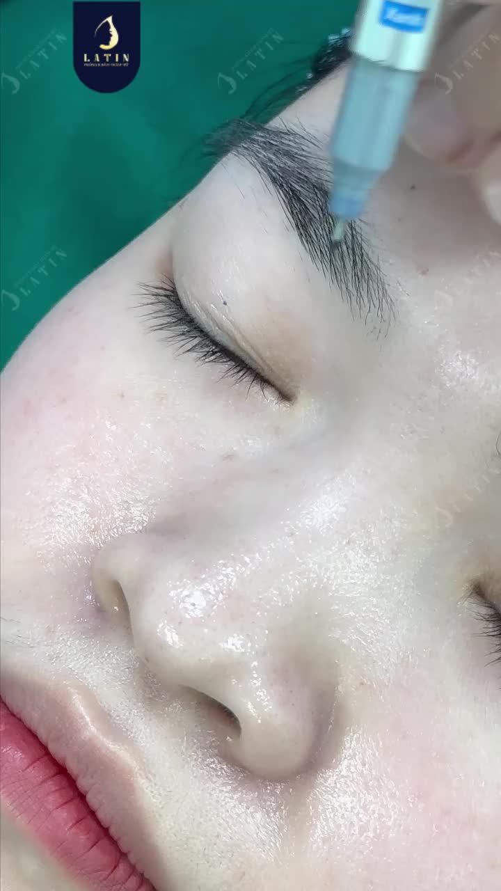 LẦN ĐẦU BẮT GẶP ÁNH MẮT BIẾT CƯỜI ĐÚNG NGHĨA