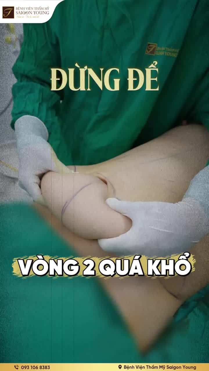 Eo dứt mỡ, da săn mịn nhờ công nghệ J-Plasma Revunion