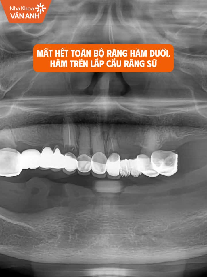 “Cô cảm ơn nha khoa đã cho cô cuộc sống mới.”
