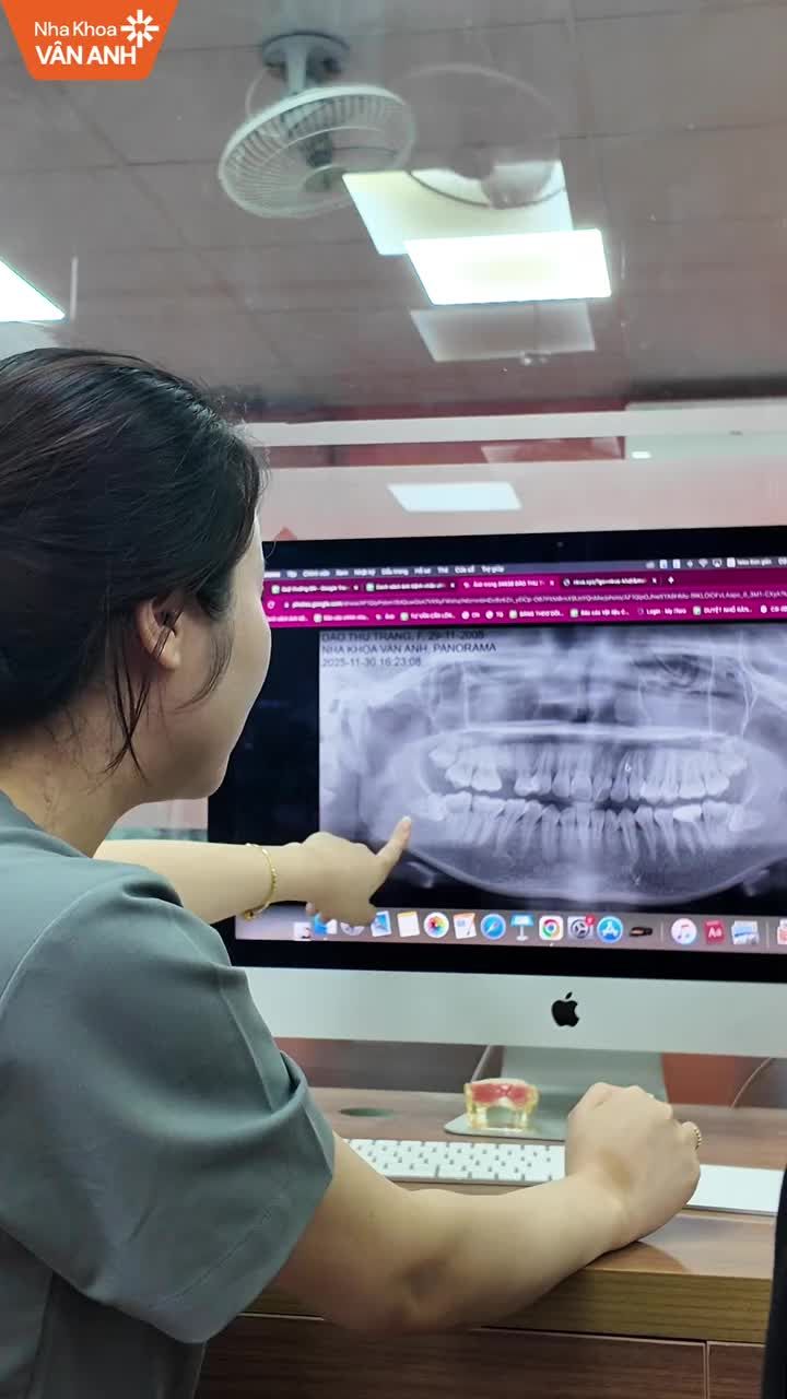 TRÌ HOÃN NHỔ RĂNG KHÔN CHO TỚI KHI THẤY ĐƯỢC TÁC HẠI CỦA NÓ TỚI CUỘC SỐNG VÀ SỨC KHOẺ