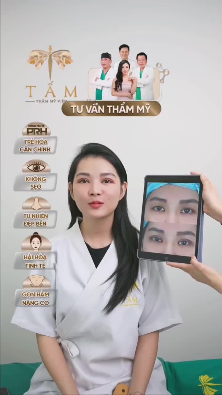 Lên sóng ngay một ca cắt mí siêu xinh