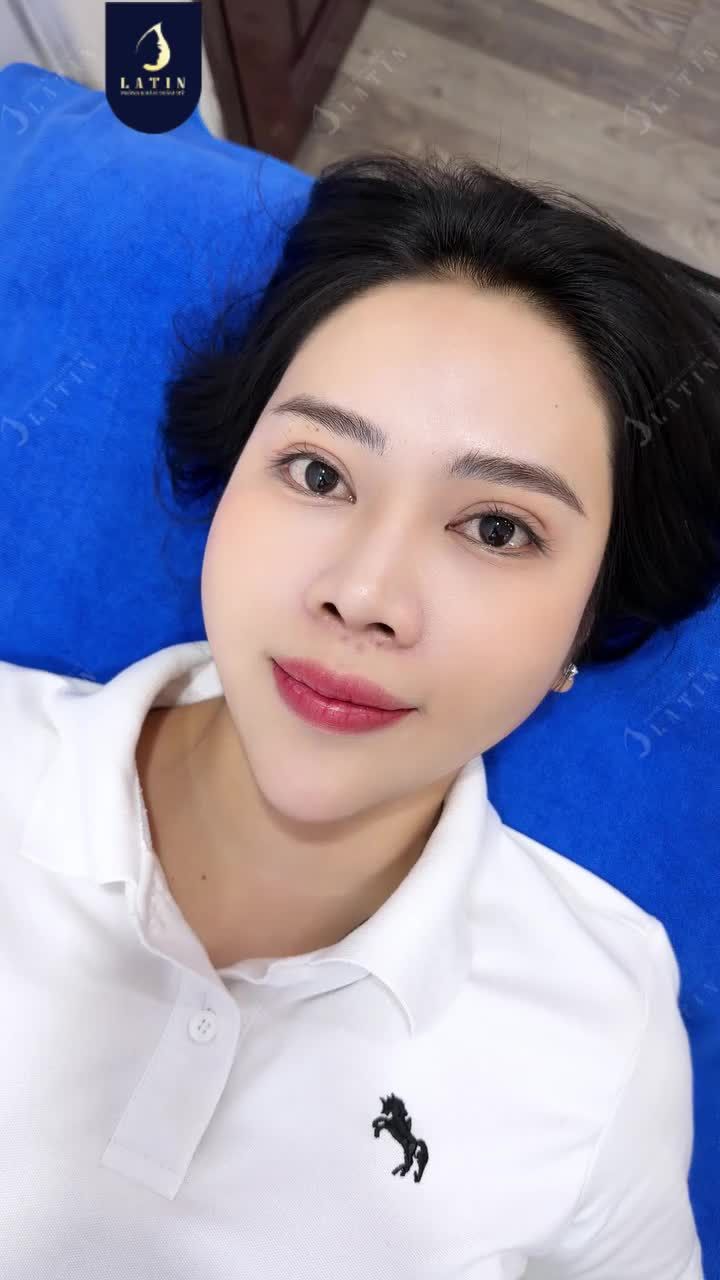 KHÁCH HÀNG NÓI GÌ SAU 1 NĂM CẮT MÍ?