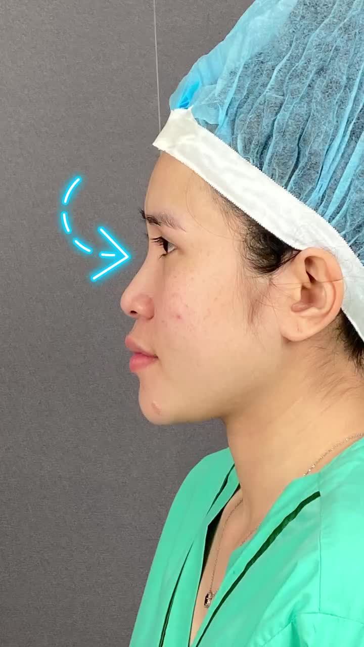 XINH ĐẸP, TRẺ TRUNG NHỜ SỞ HỮU DÁNG MŨI PHÙ HỢP!!