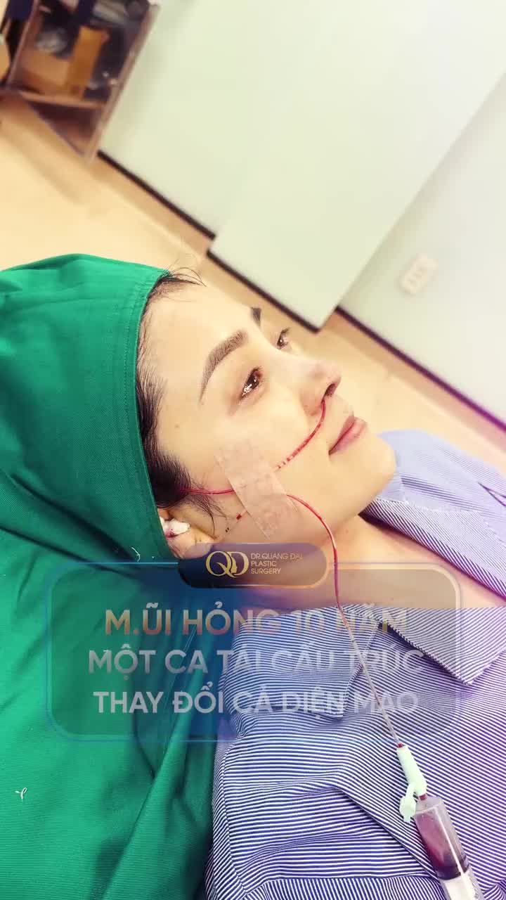 MŨI HỎNG 10 NĂM - MỘT CA TÁI CẤU TRÚC THAY ĐỔI CẢ DIỆN MẠO