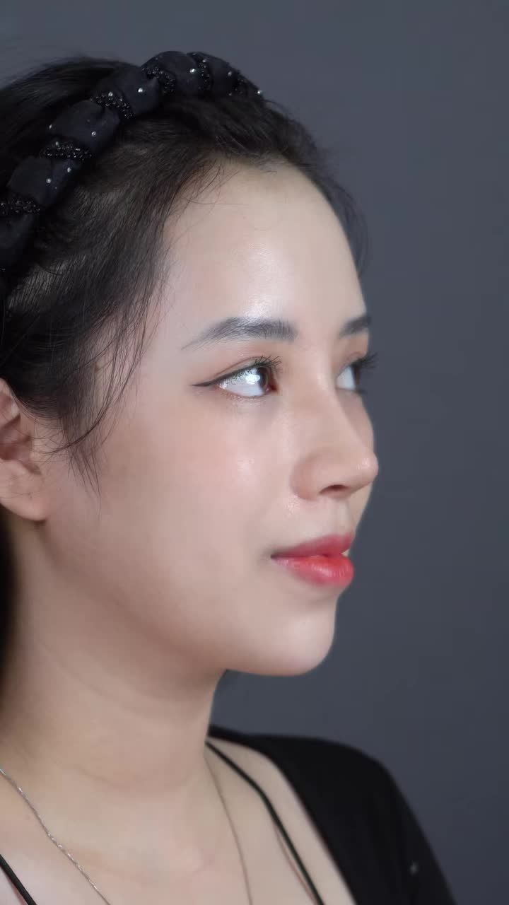 MŨI BỌC SỤN 17 TR ĐẸP NHƯ CẤU TRÚC 40TR  XEM NGAY NHA!!!