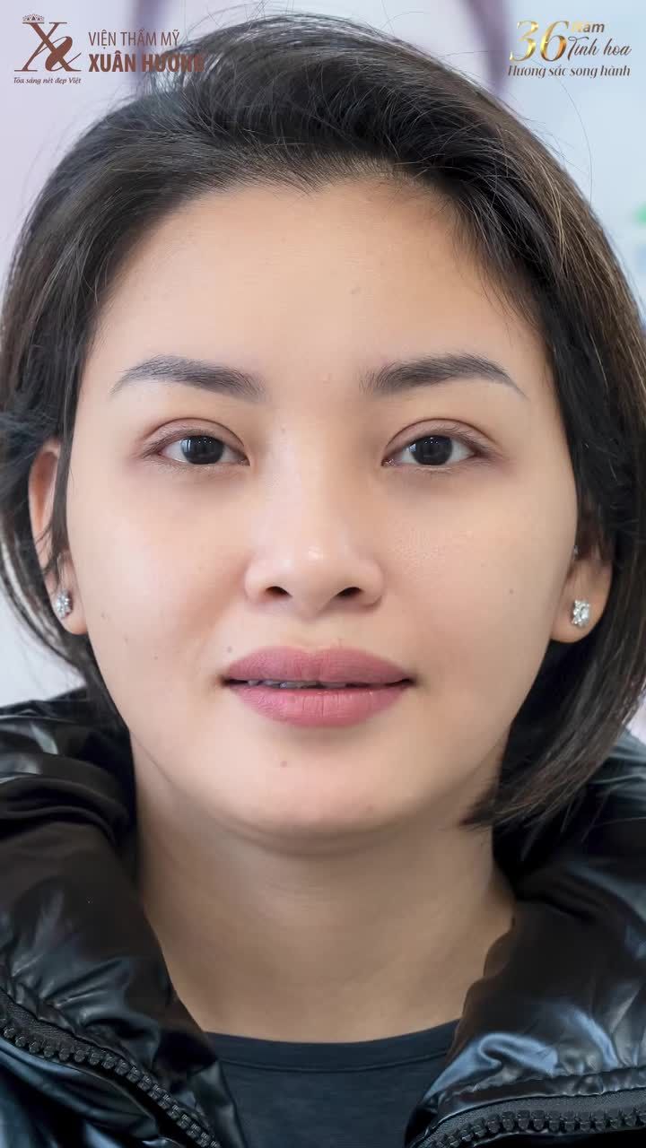 CẮT MÍ SAU BAO LÂU HẾT SƯNG?