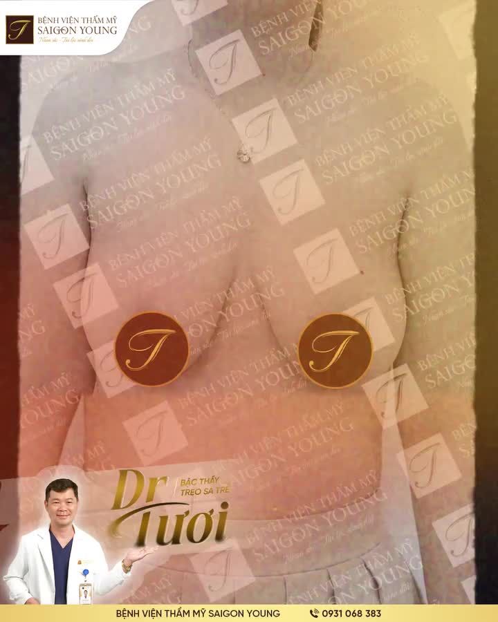 Cái giá phải trả khi chọn Saigon Young để TREO SA TRỄ