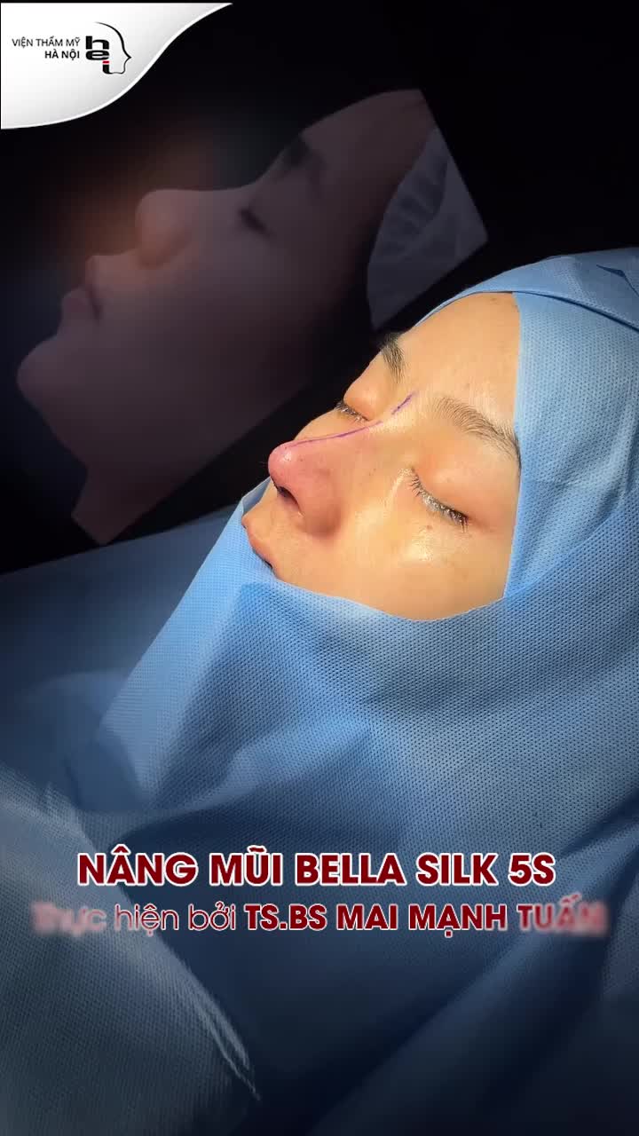 NÂNG MŨI BELLA SILK 5S