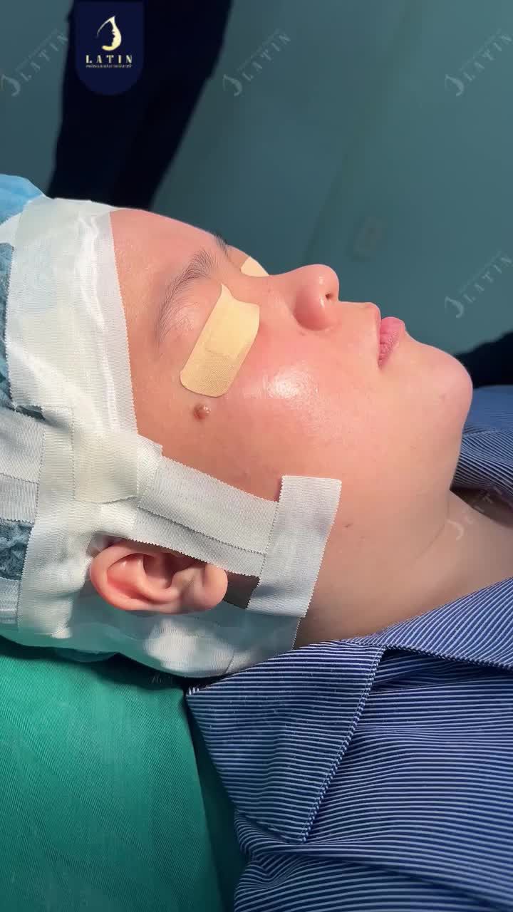 KHI CHIẾC MŨI ĐÚNG DÁNG, GÓC NGHIÊNG THÀNH "ĐẶC SẢN"