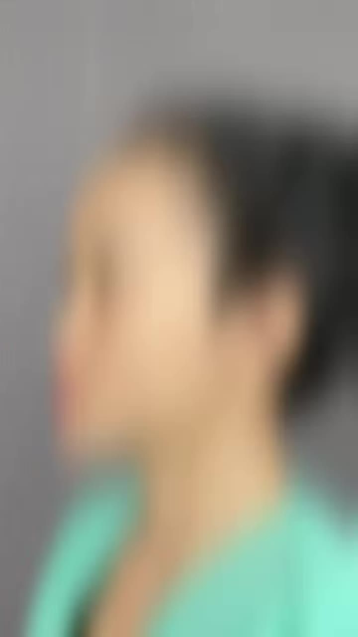 MŨI 10 NGÀY VÀO FORM ĐẸP XUẤT SẮC!!