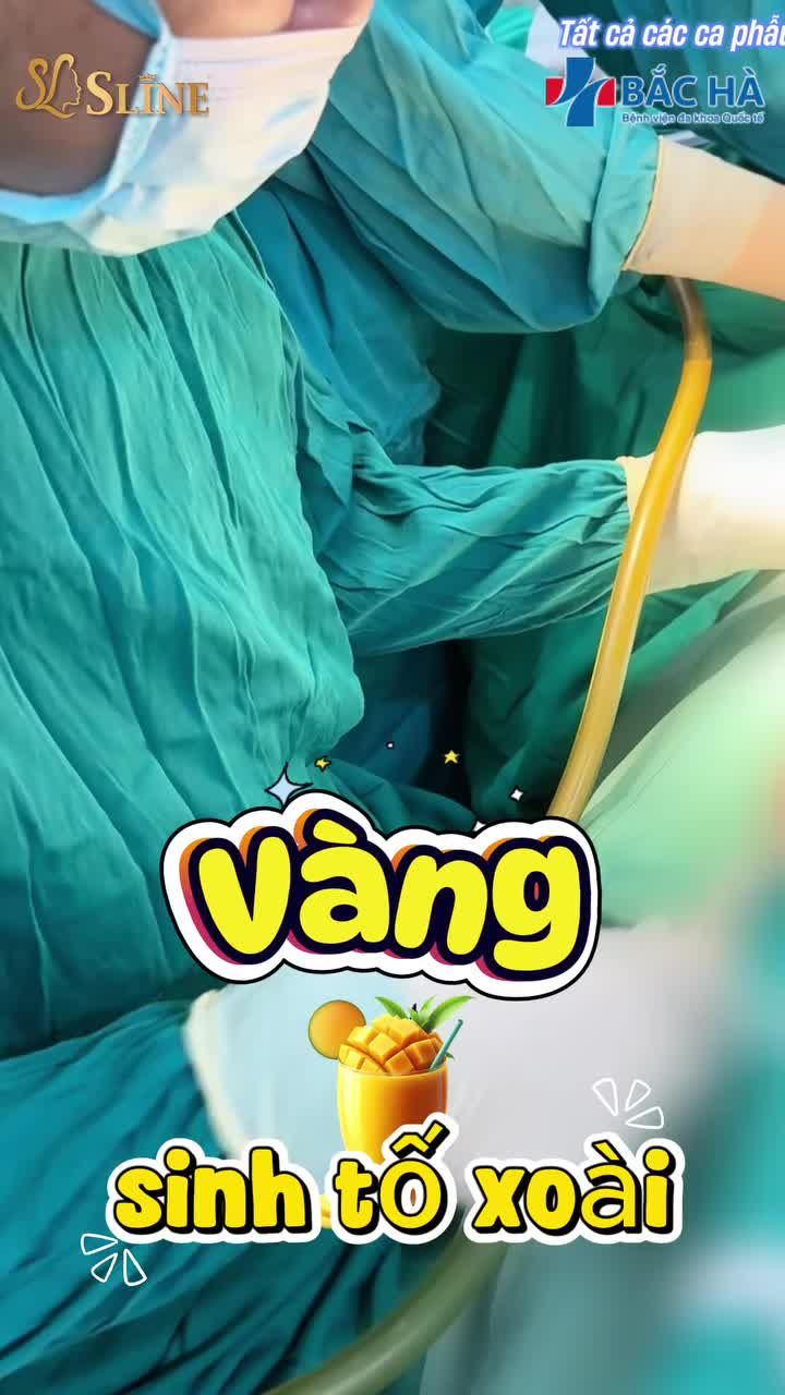 CÁNH TAY GỌN LẠI – ƯU ĐÃI CHẠM ĐÁY CUỐI NĂM