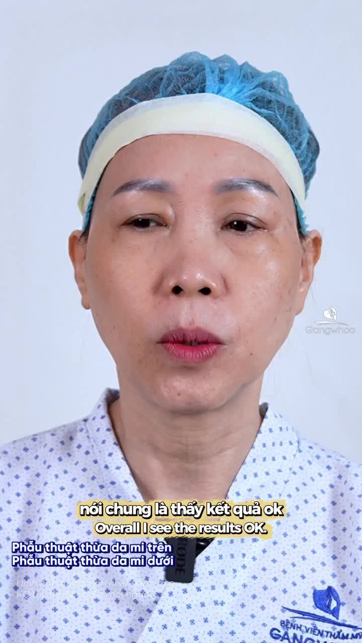Chị khách vừa ghé Gangwhoo thực hiện combo mí trên mí dưới. Cùng đón chờ màn thay đổi của chị nhé!
