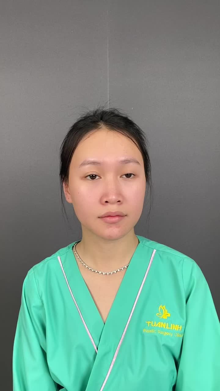 Mũi 10 ngày vào form đẹp tự nhiên!!