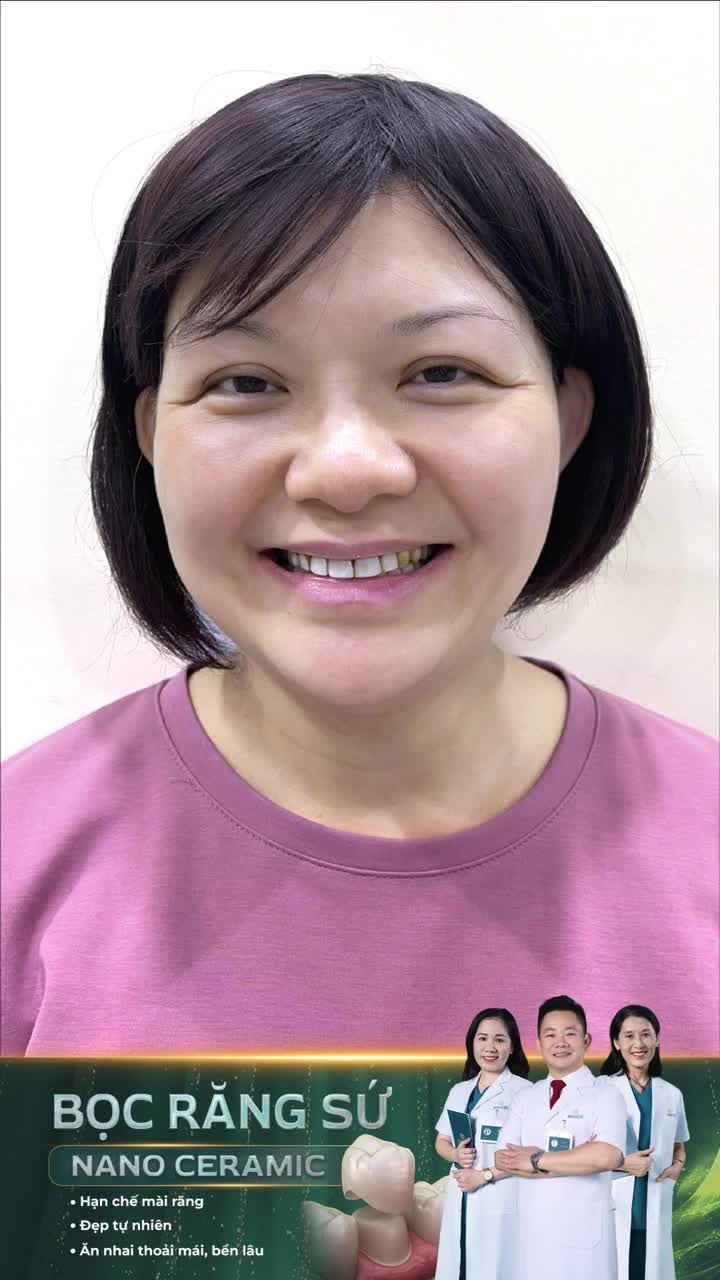 Bọc răng sứ để có nụ cười khỏe đẹp