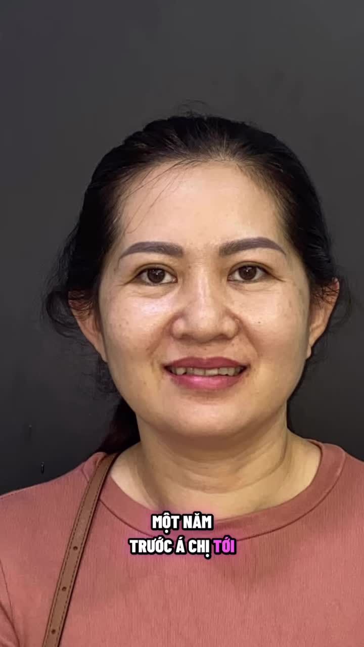 Lớn tuổi có niềng răng được không ?