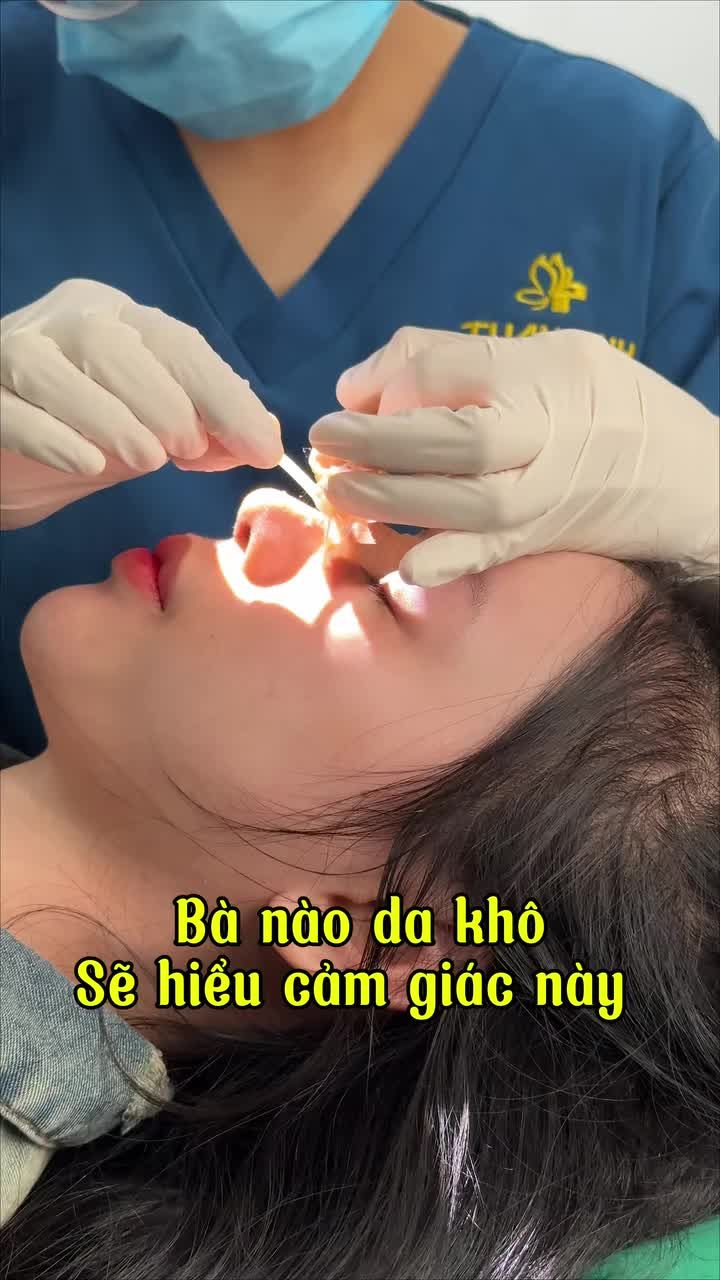 Da khô tháo nẹp sẽ hơi rát chút xíu...Mà tháo xong mũi đẹp xuất sắc như này thì quá là ƯNG!!