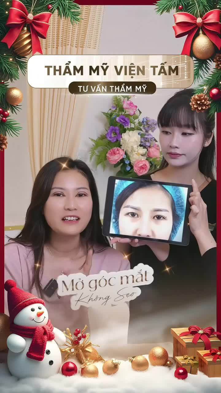 "Chỉ vì đôi mắt nên nhìn tổng thể cơ địa rất cọc, ra đường ai cũng nghĩ khó gần"