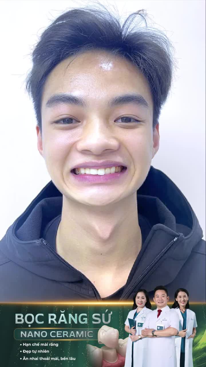 Tôi đã tự tin hơn rất nhiều sau bọc răng sứ