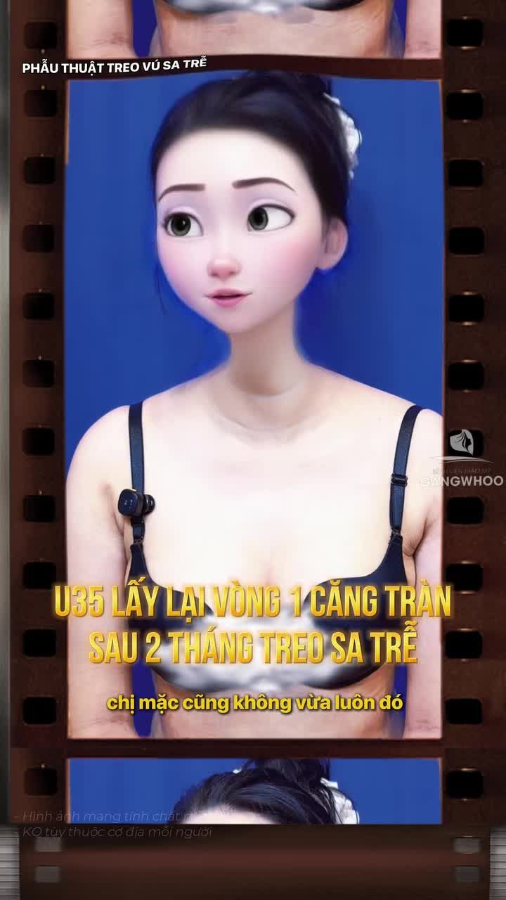 U35 lấy lại vòng 1 căng tràn sau 2 tháng treo sa trễ