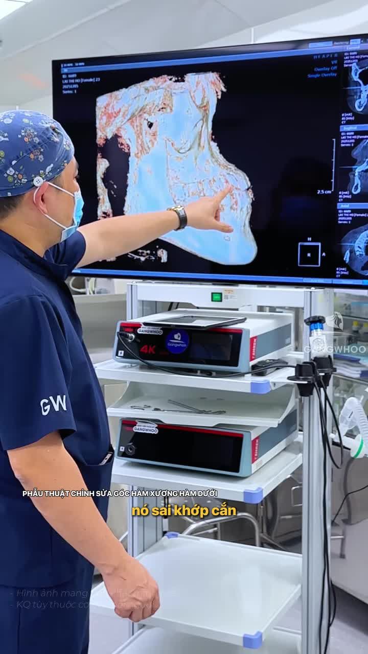 PHÂN TÍCH GÓC HÀM TRƯỚC PHẪU THUẬT – MỌI CHUẨN MỰC BẮT ĐẦU TỪ ĐÂY