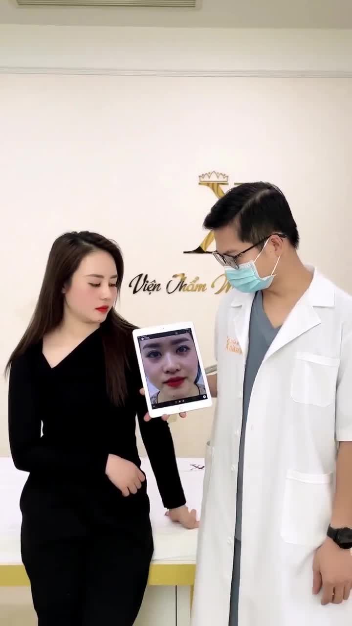 DÁNG MŨI SAU 10 NGÀY CẮT CHỈ