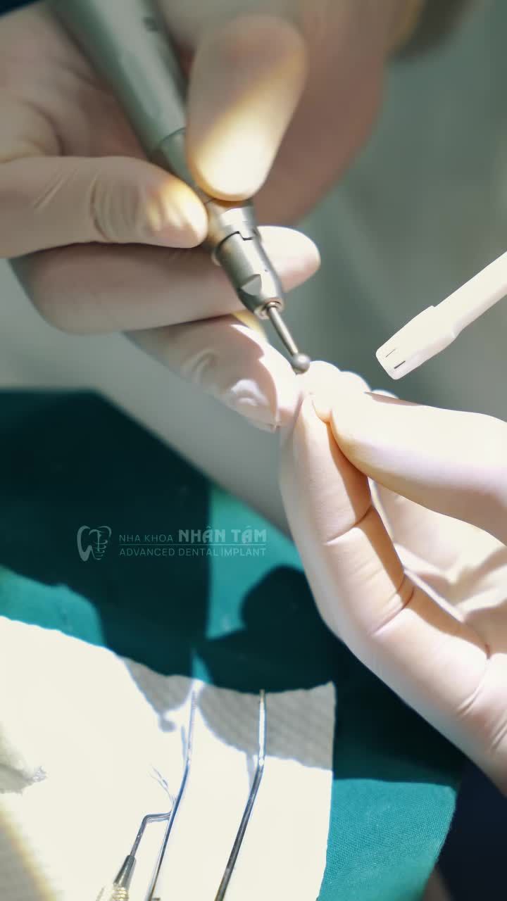 KHI NỤ CƯỜI THAY ĐỔI - SỰ TỰ TIN CŨNG TĂNG LÊN RÕ RỆT