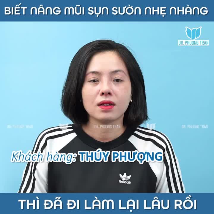 “Nếu biết nâng mũi sụn sườn lại nhẹ nhàng như thế này, chắc em đã làm sớm hơn rồi.”