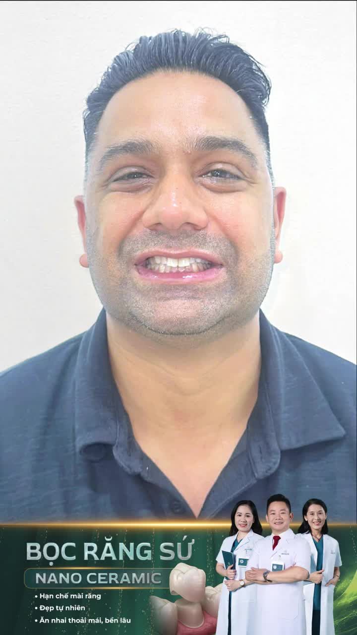 Khách nước ngoài vui mừng với nụ cười mới sau bọc răng sứ