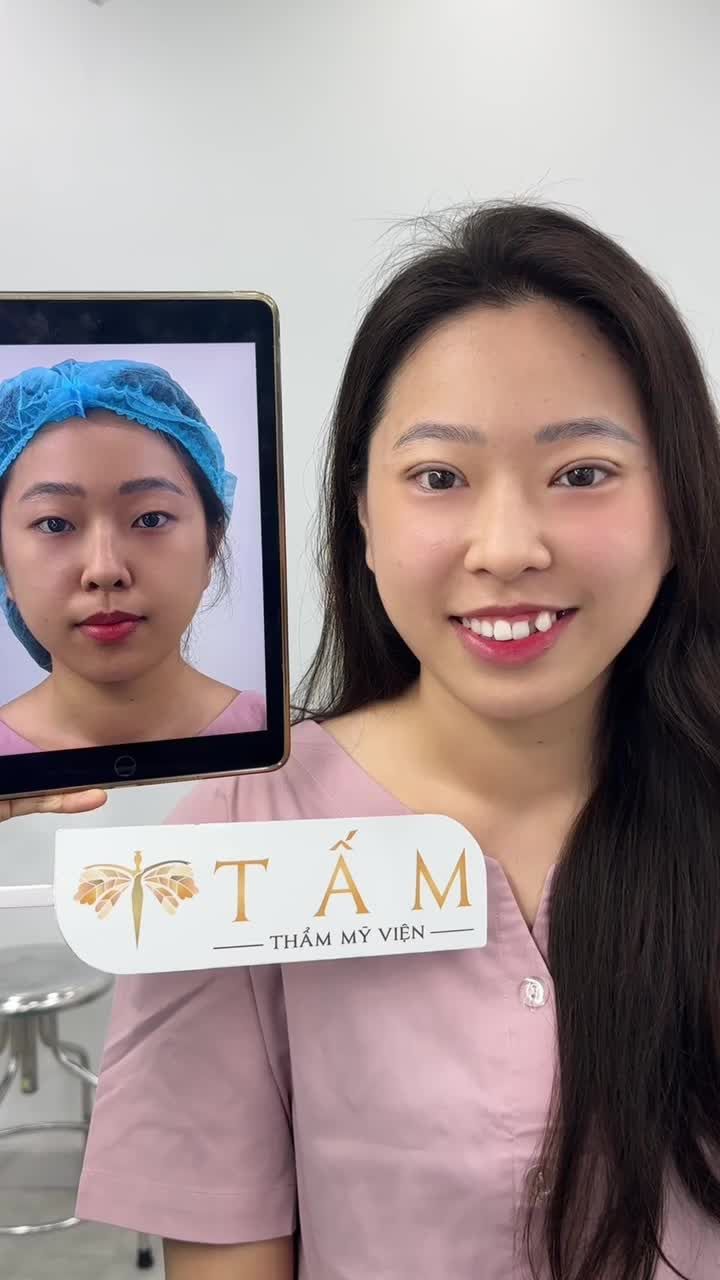 "Cắt xong em thấy khác hoàn toàn chị ạ, chưa quen với sự xinh đẹp này, lúc làm em chả thấy đau gì "