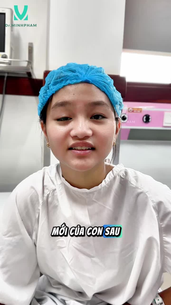 Các cô chú hãy cùng đón chờ đôi mắt mới của bé Thanh Trà sau phẫu thuật sụp mi được thực hiện bởi bác sĩ Minh nhé