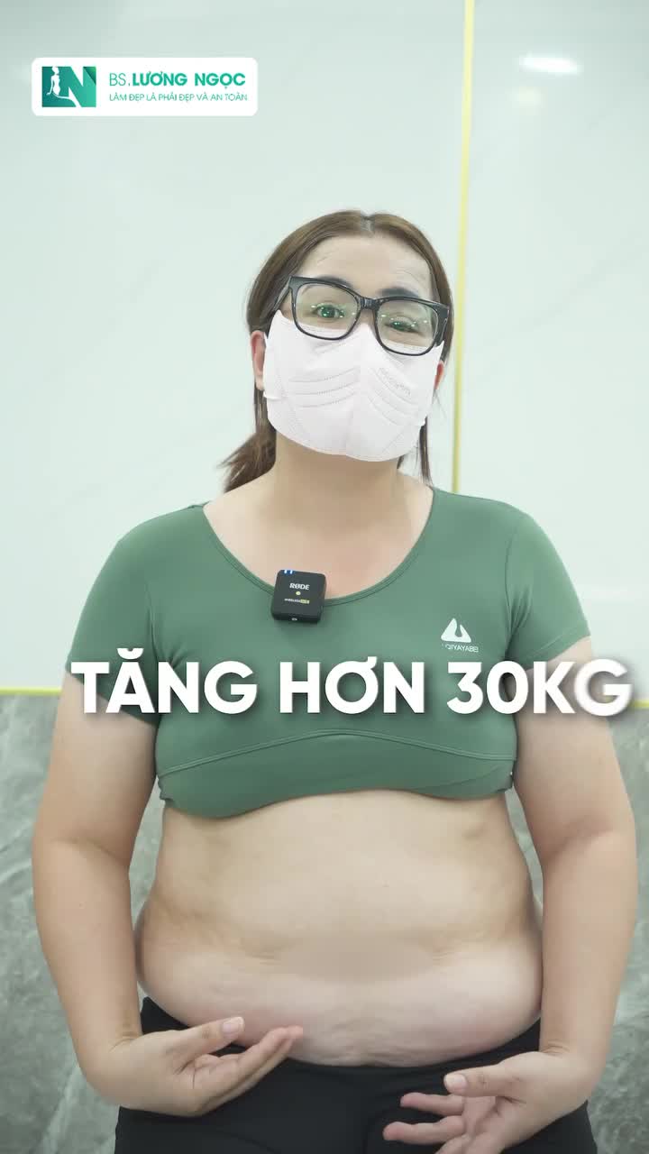 TỪ BỤNG KHỦNG 116CM SAU 2 LẦN SANH MỔ GIẢM NGAY 25CM SAU 2 GIỜ Hành trình thay đổi của chị H.N – và lý do chị quyết định chọn BSLN.