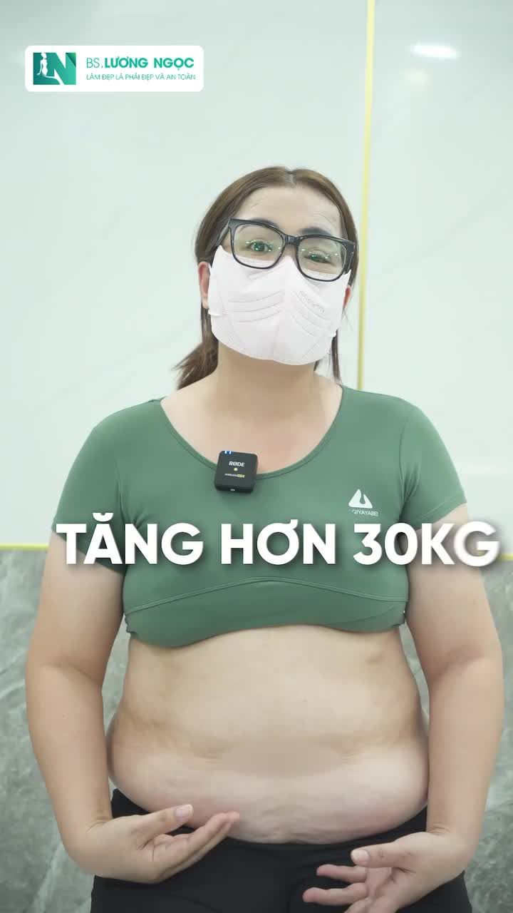 TỪ BỤNG KHỦNG 116CM SAU 2 LẦN SANH MỔ GIẢM NGAY 25CM SAU 2 GIỜ Hành trình thay đổi của chị H.N – và lý do chị quyết định chọn BSLN.