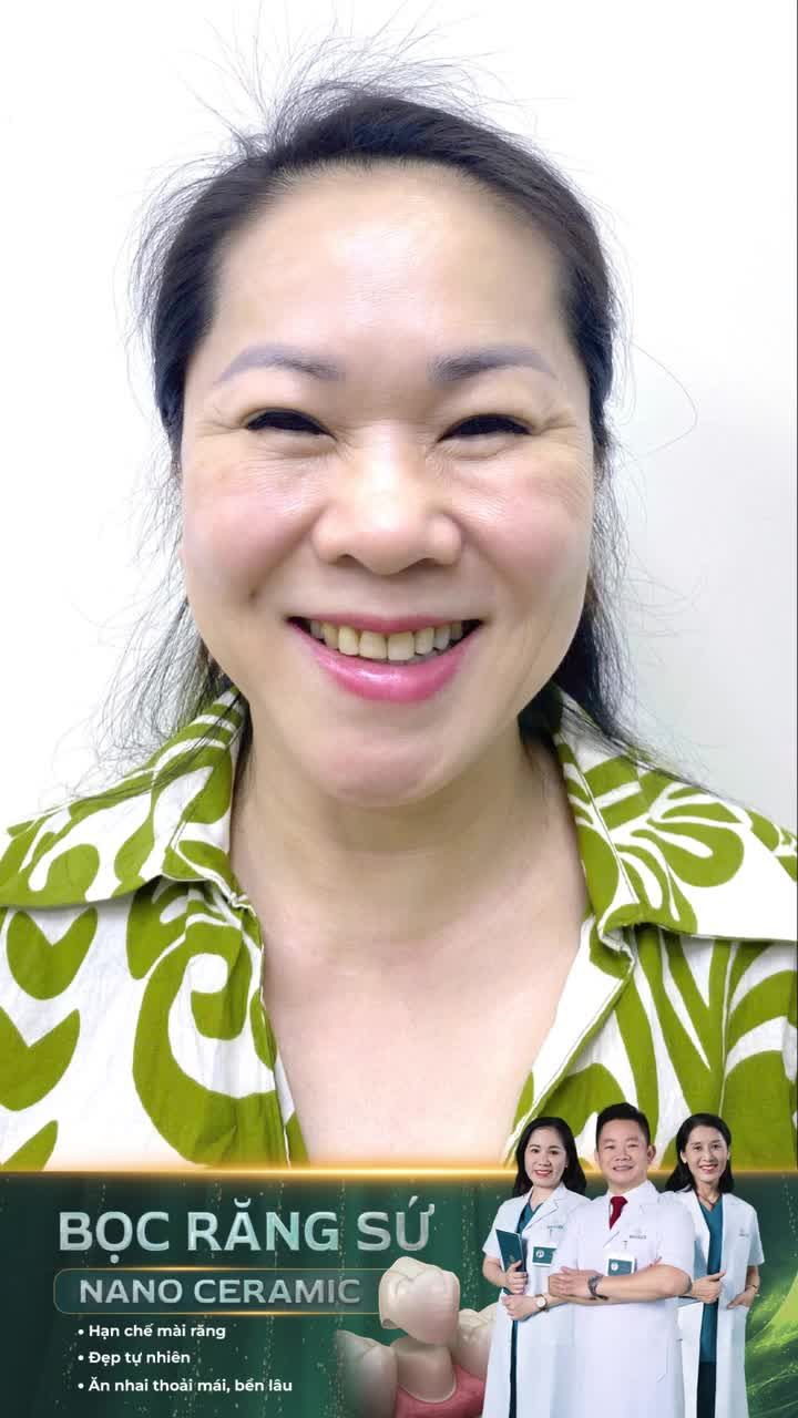 Lấy lại nụ cười thanh xuân sau bọc răng sứ