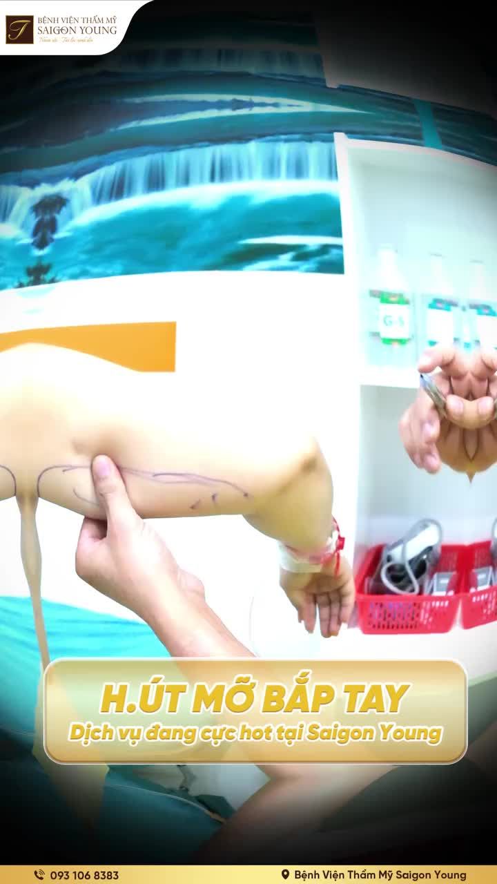 BẮP TAY THON XINH  Kết hợp công nghệ J - Plasma  Tối ưu kết quả nhờ giảm mỡ, co da ngay sau thực hiện.