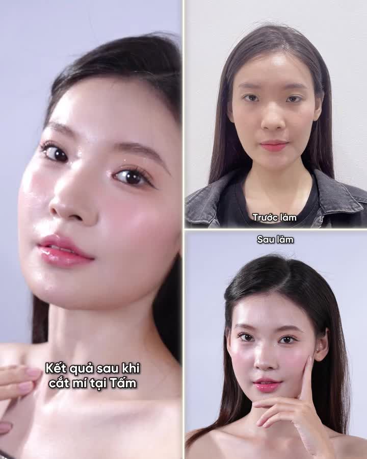 " Từ khi làm mí xong mọi người khen xinh, mình cũng tự tin hơn nhiều rồi!"