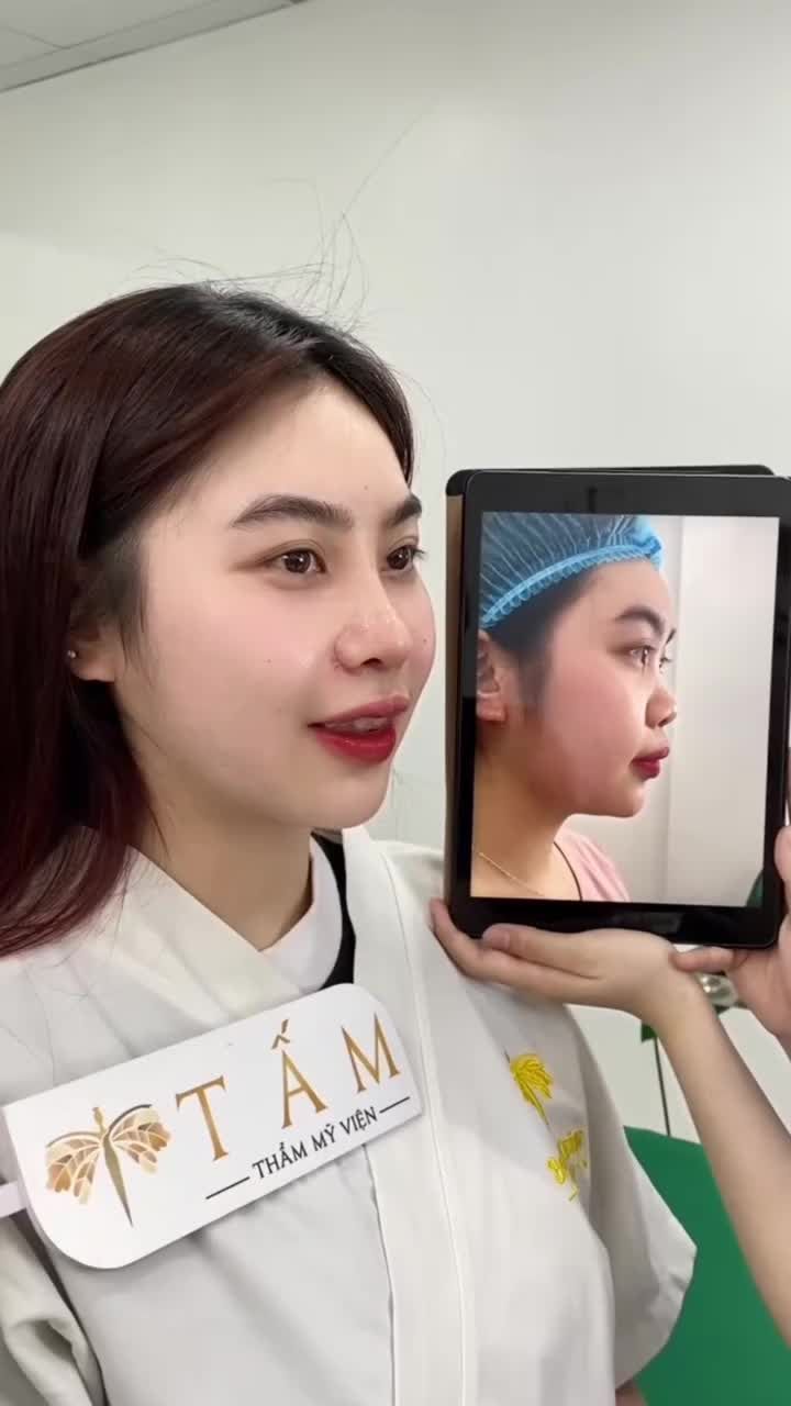 Bạn Linh chia sẻ: " Trước khi làm em khá sợ đau, nhưng khi nâng mũi xong lại thấy thoải mái, vì không đau như tưởng tượng"