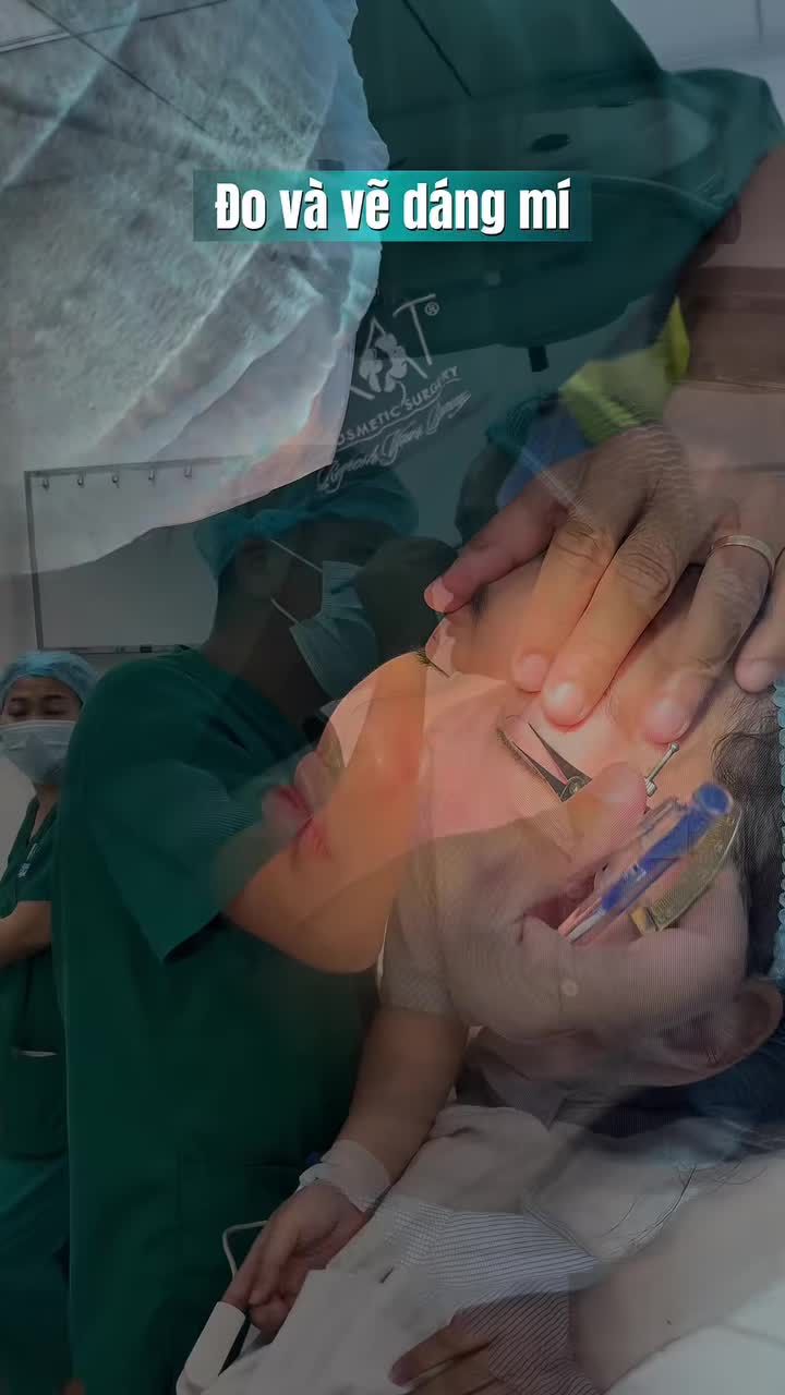 +1 Đôi mắt KHÔNG MỠ KHÔNG DA DƯ KHÔNG MÍ SỤP