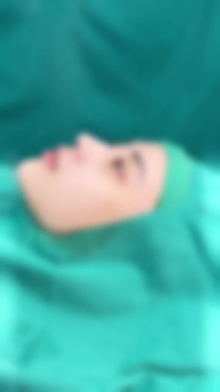 NÂNG MŨI CẤU TRÚC - ĐẸP SANG TỪNG GÓC NHÌN!!