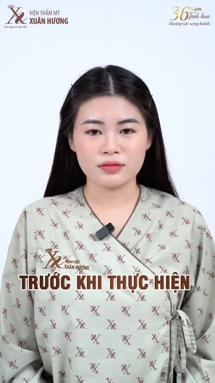TẠM BIỆT MIẾNG DÁN KÍCH MÍ CHỈ VỚI 1 LẦN CẮT MÍ TẠI VTM XUÂN HƯƠNG