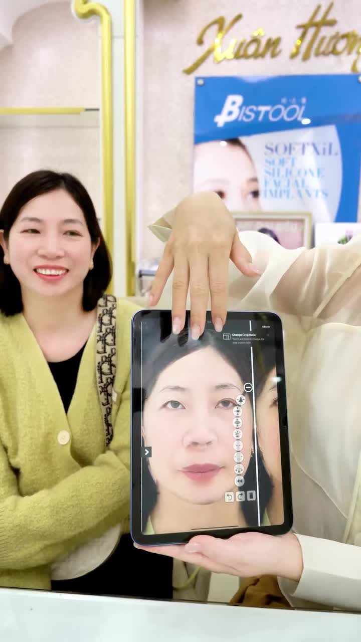 CHỦ TỊCH XUÂN HƯƠNG TƯ VẤN DỊCH VỤ CẮT MÍ AI VISION CHO KHÁCH HÀNG SỤP MÍ, NHIỀU DA CHÙNG