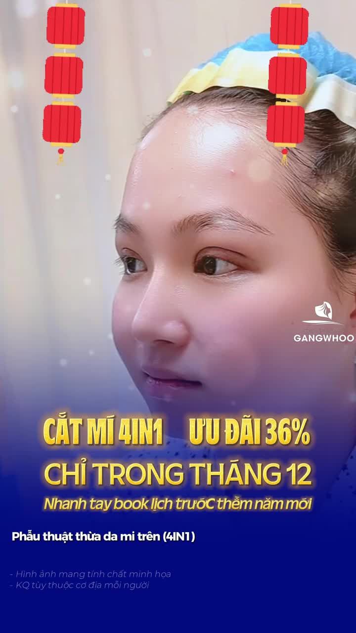 Muốn đôi mắt đẹp đón Tết, bây giờ có muộn không?