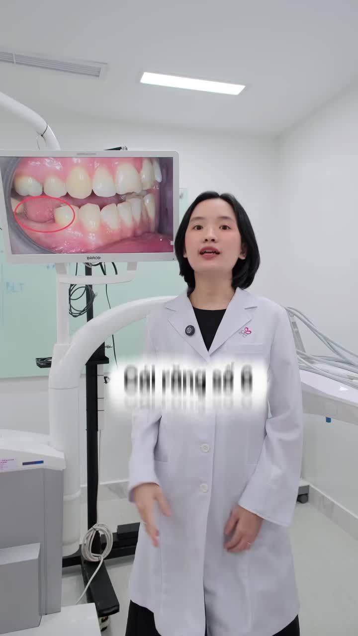 CHIẾC RĂNG “CỰC QUAN TRỌNG” NHƯNG HẦU NHƯ AI CŨNG SÂU HOẶC RỤNG SỚM RĂNG SỐ 6.